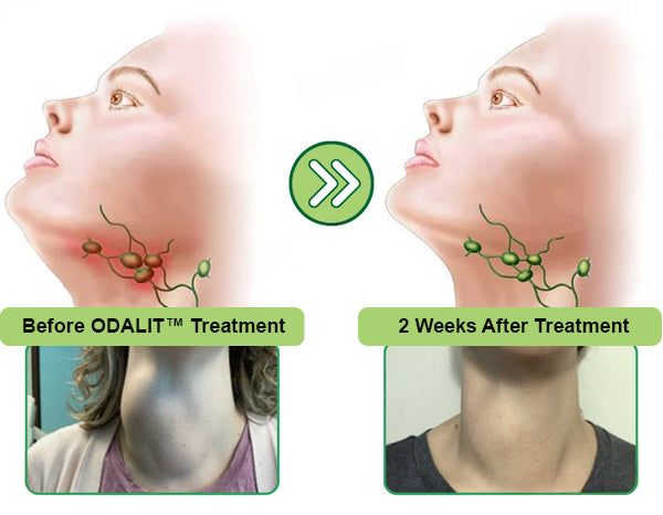 ODALIT™ Herbal Lymphatic Detox Cream