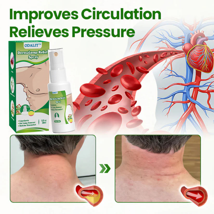 ⏰Last Day Promotion: 60% OFF🔥ODALIT™ DermaLump Relief Spray