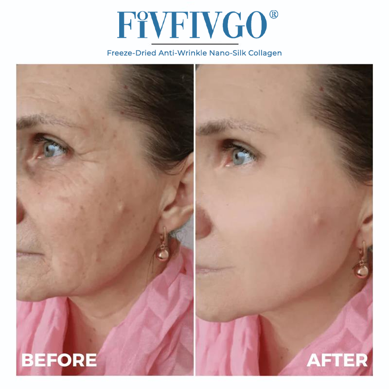 ODALIT™ Freeze-Dried Anti-Wrinkle Nano-Silk Collagen