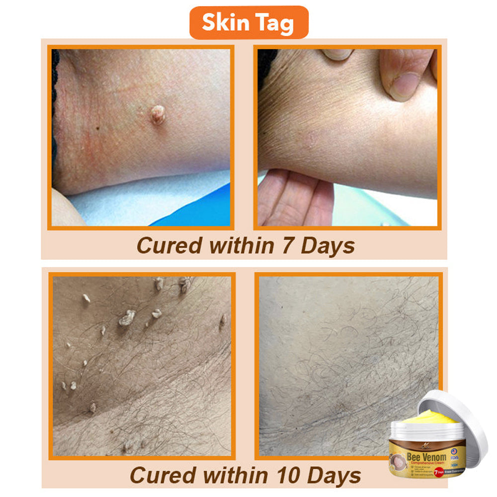 🐝Bee Venom Comprehensive Cream 🇺🇸 Dermatologist Recommended