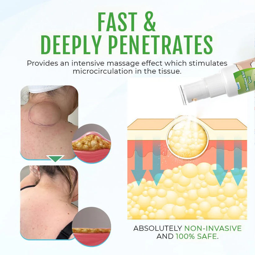 ⏰Last Day Promotion: 60% OFF🔥ODALIT™ DermaLump Relief Spray