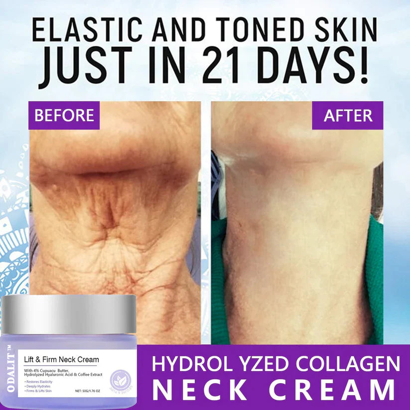 ✨Last Day Discount: 70% OFF🌸 ODALIT™ Neck Cream