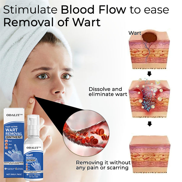 ODALIT⢠Fast-Active Wart Removal Ointment