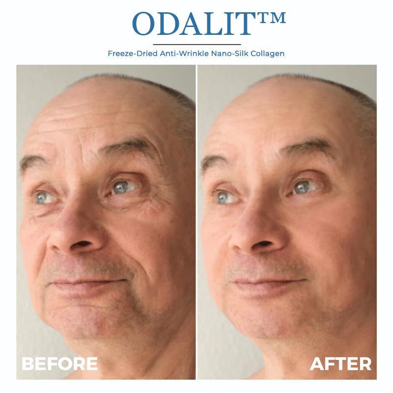 ODALIT™ Freeze-Dried Anti-Wrinkle Nano-Silk Collagen
