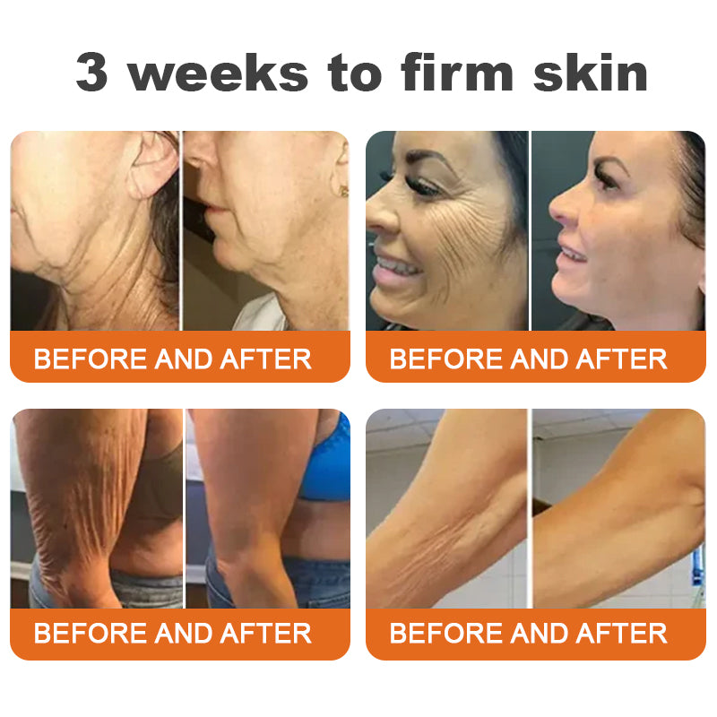 Made and Shipped from USA✨ODALIT™ Botox Bee Venom Firming Serum Stick(🔥LAST DAY 70% OFF)✨
