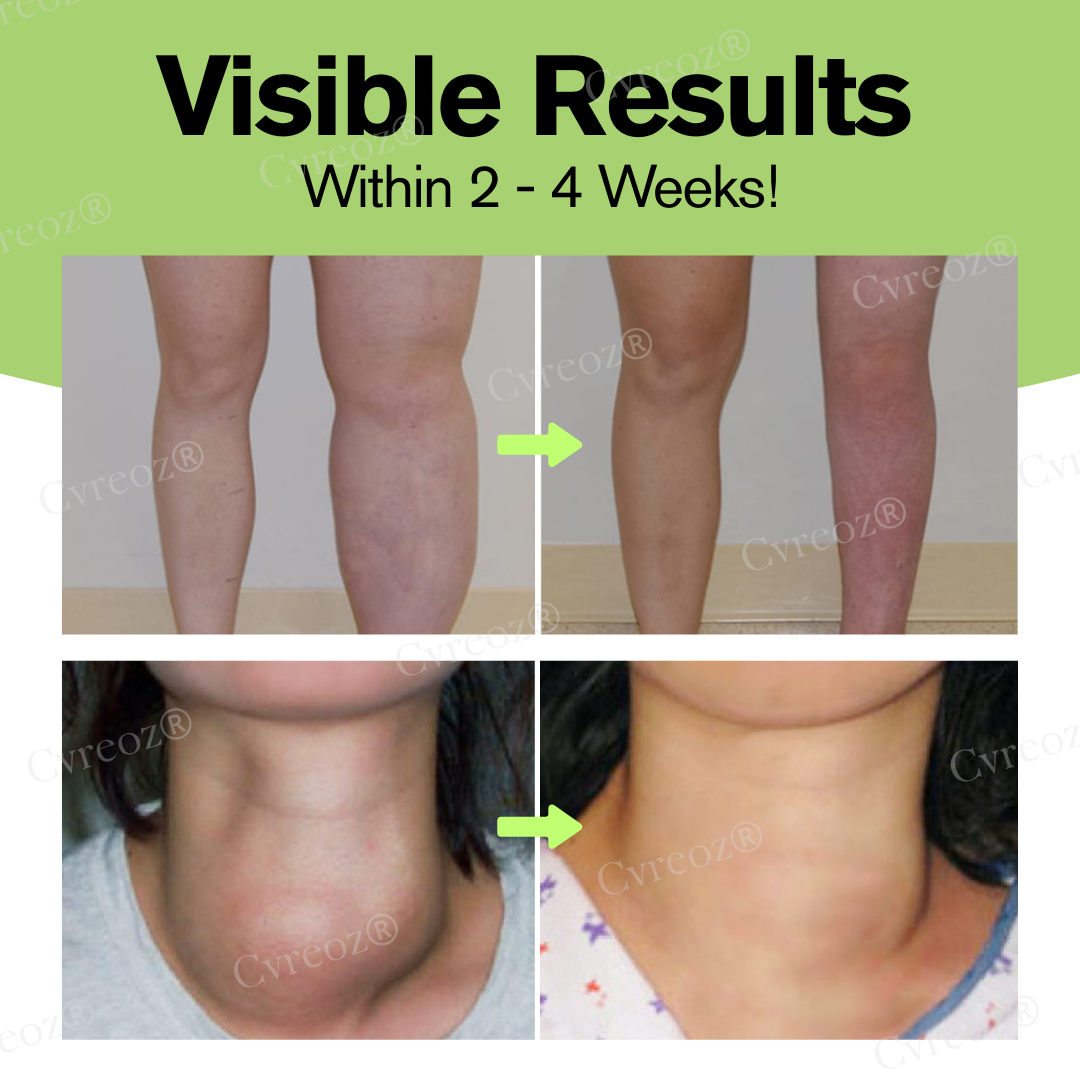 ODALIT™ Herbal Lymphatic Detox Cream