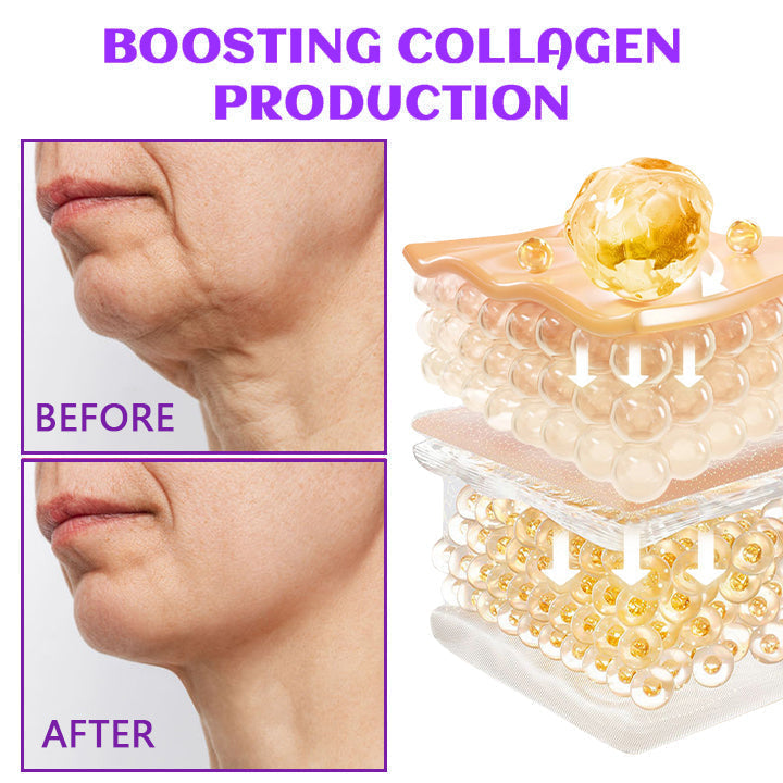✨Last Day Discount: 70% OFF🌸 ODALIT™ Neck Cream