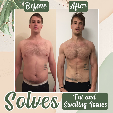 Natural Detox Slimming Patch(Limited Time Discount 🔥 Last Day)