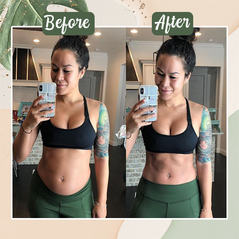 Natural Detox Slimming Patch(Limited Time Discount 🔥 Last Day)