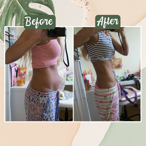 Natural Detox Slimming Patch(Limited Time Discount 🔥 Last Day)