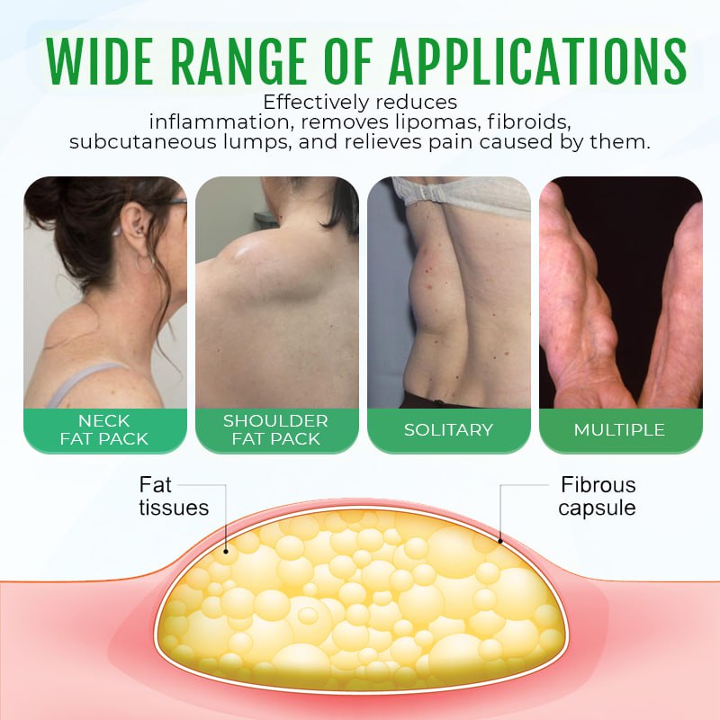 ⏰Last Day Promotion: 60% OFF🔥ODALIT™ DermaLump Relief Spray