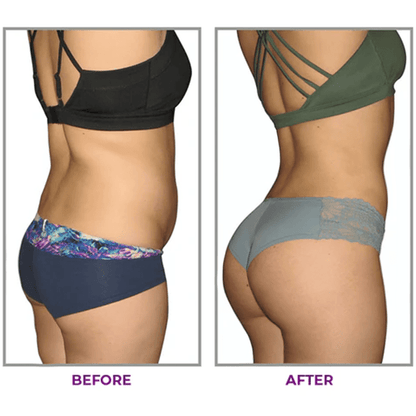 KISSHI™ Hip Plump Capric Oil D002