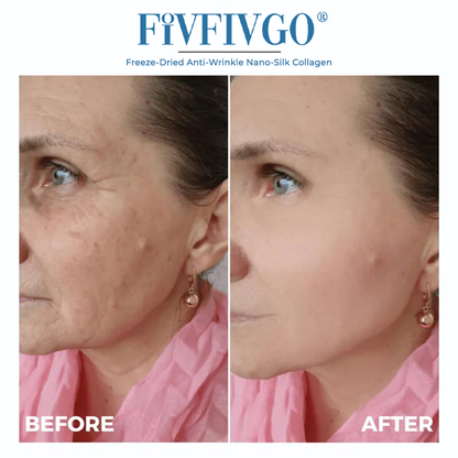 ODALIT™ Freeze-Dried Anti-Wrinkle Nano-Silk Collagen