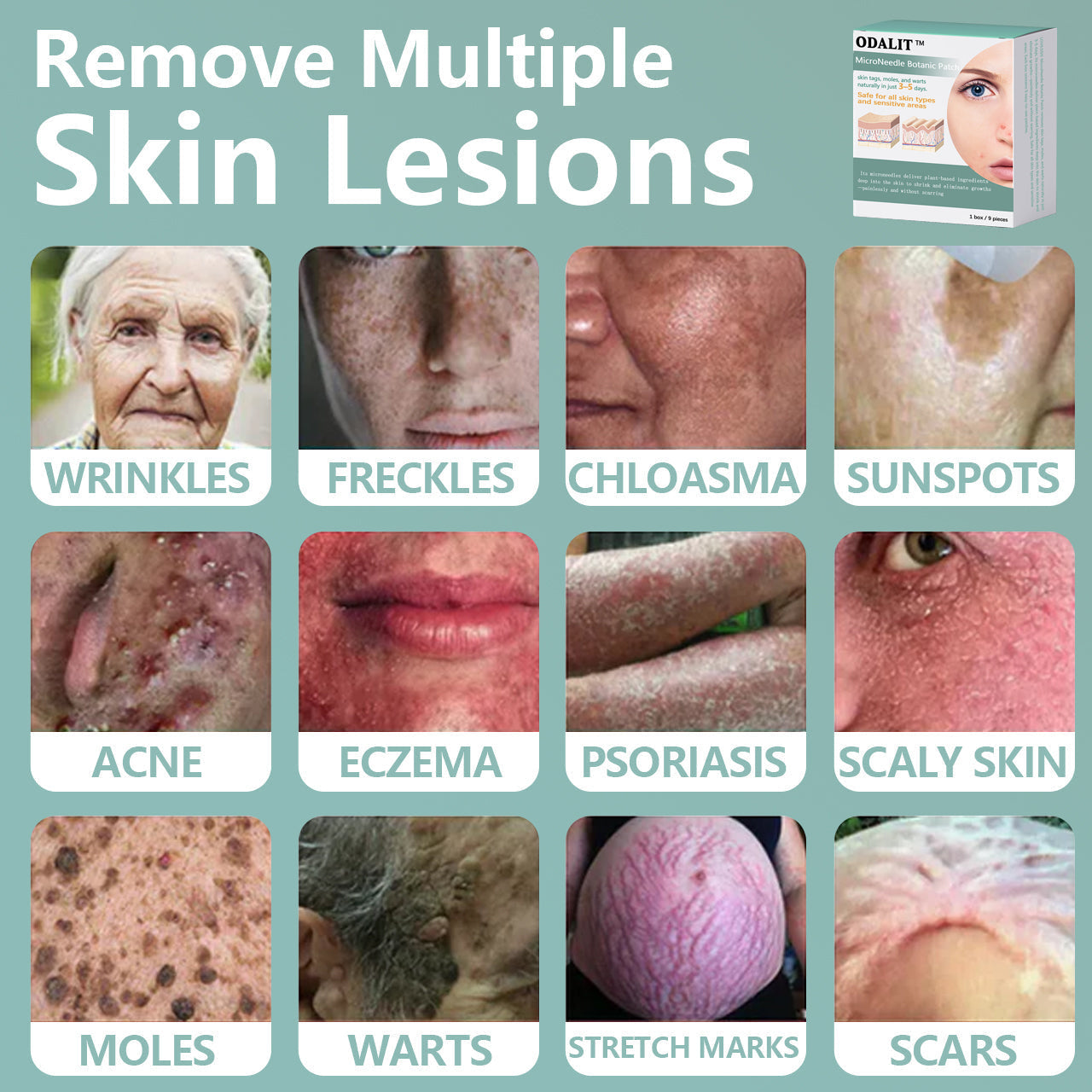 ✨ODALIT™ MicroNeedle Botanic skin Tag Removal Patch