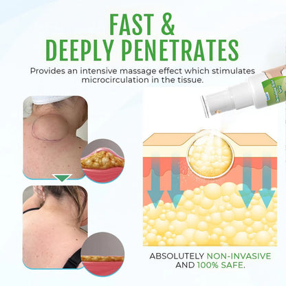 ⏰Last Day Promotion: 60% OFF🔥ODALIT™ DermaLump Relief Spray