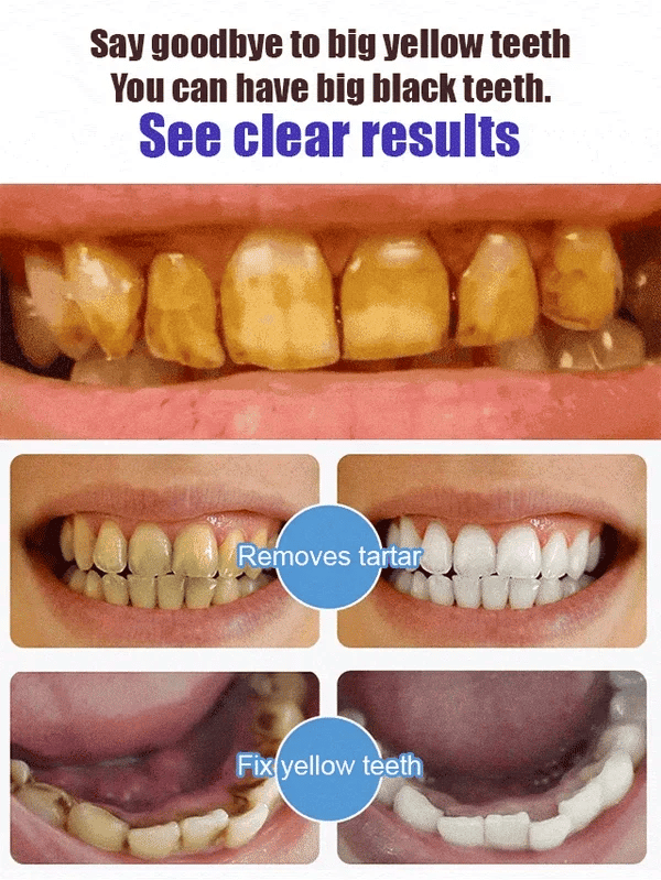 🦷Fluoride-Free Hydroxyapatite Toothpaste| Enamel Repair | Breath Freshening |Effective whitening