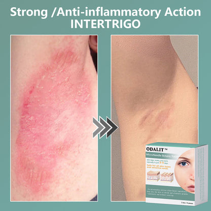 ✨ODALIT™ MicroNeedle Botanic skin Tag Removal Patch
