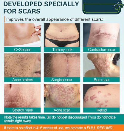 ❤️Advanced Scar Spray For All Types of Scars - Acne Scars, Surgical Scars and Stretch Marks ⚡️⚡️⚡️