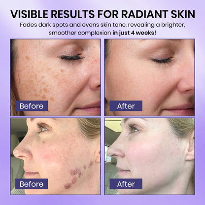 ODALIT™ Radiglow Brightening Dark Spot Gel